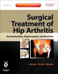 Surgical Treatment of Hip Arthritis: Recontruction, Replacement, and Revision