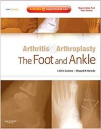 Arthristis&Arthroplasty the Foot and Ankle