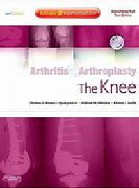 Arthritis & Arthroplasty The Knee