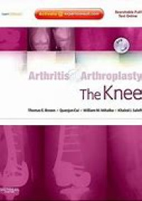 Arthritis Arthroplasty The Knee