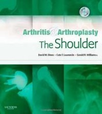 Arthritis Arthroplasty The Shoulders