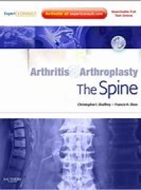 Arthritis & Arthroplasty The Spine