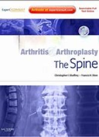 Arthritis Arthroplasty The Spine