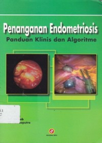 Penanganan Endometriosis : Panduan Klinis dan Algoritme